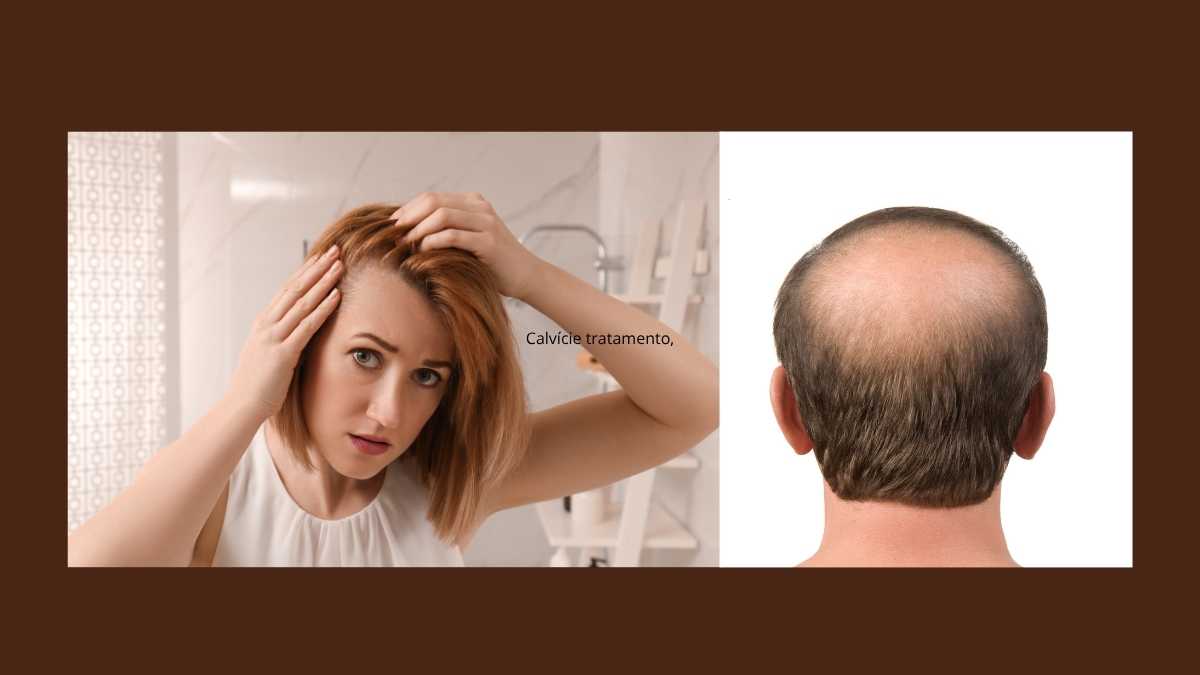 Calvície tratamento